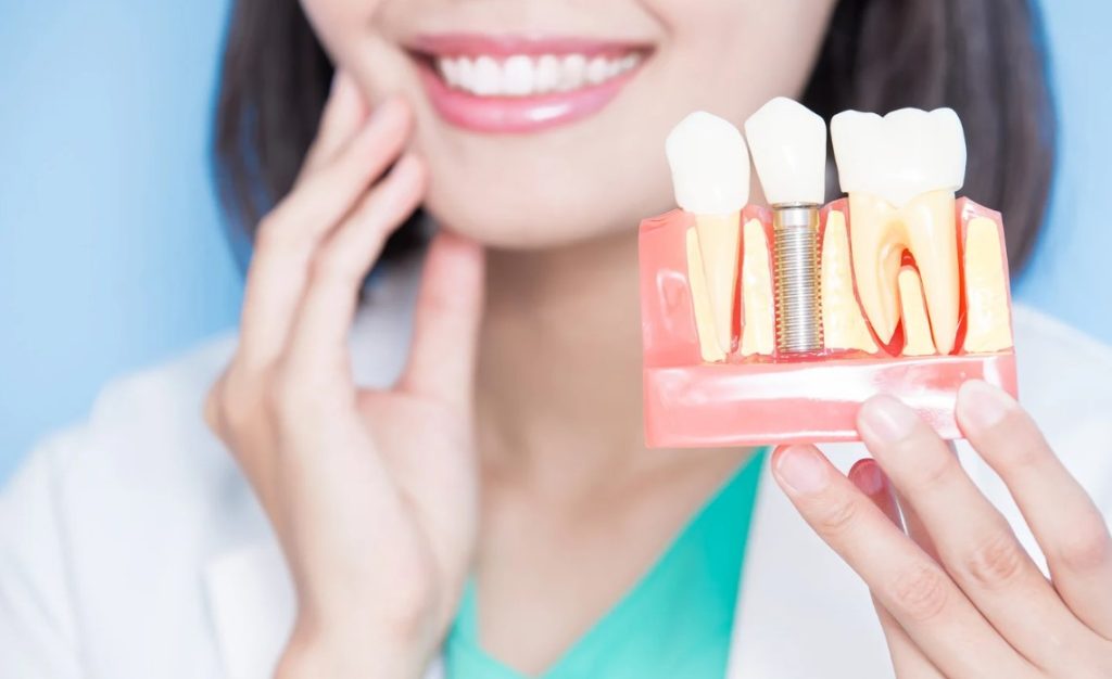 A smiling dental professional holding a model showing the differences between dental implants and natural teeth.